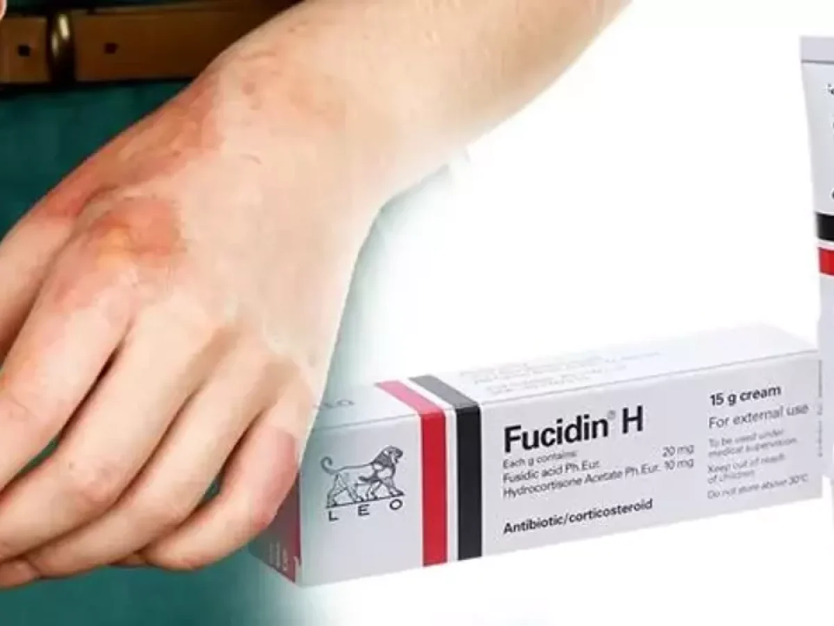 Fucidin H  فيوسيدين - إتش 