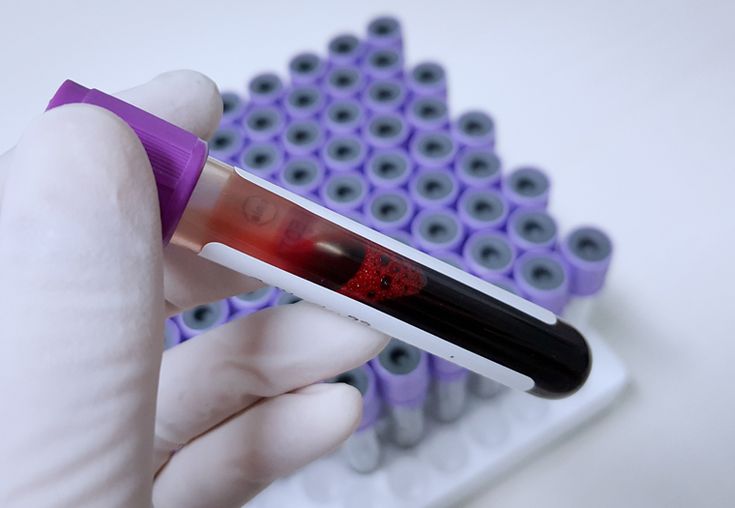 تحليل تعداد الدم الكامل Complete Blood Count Test