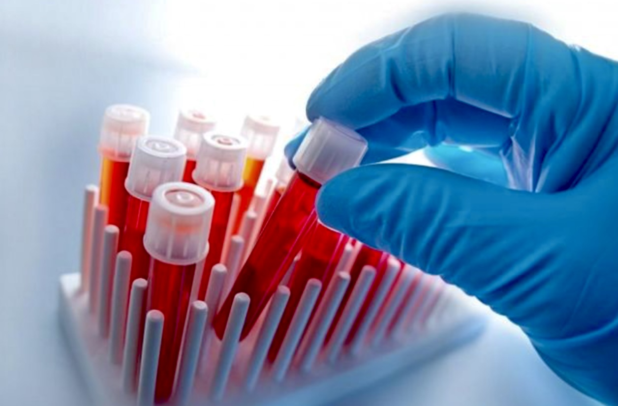 تحليل تعداد الدم الكامل Complete Blood Count Test