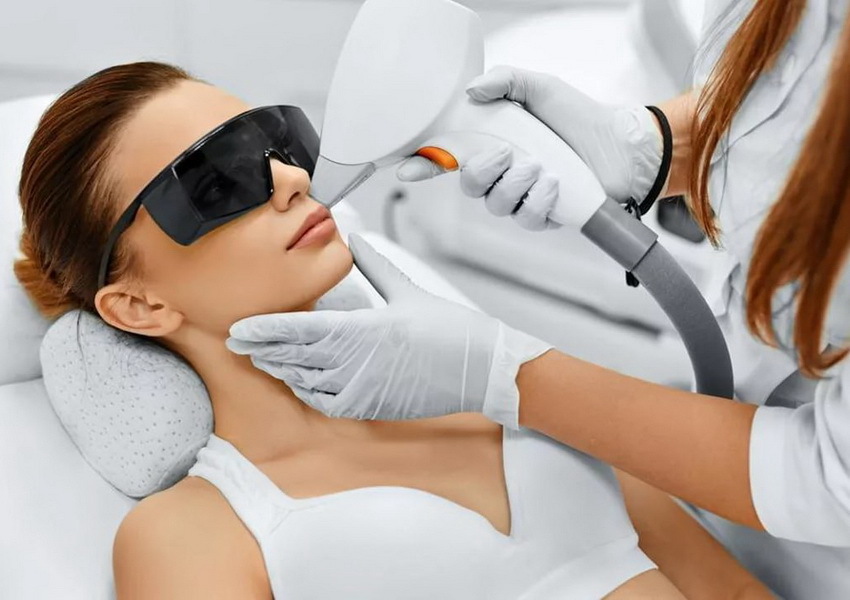 دليلك لإزالة الشعر بالليزر: المميزات والتكلفة والجلسات