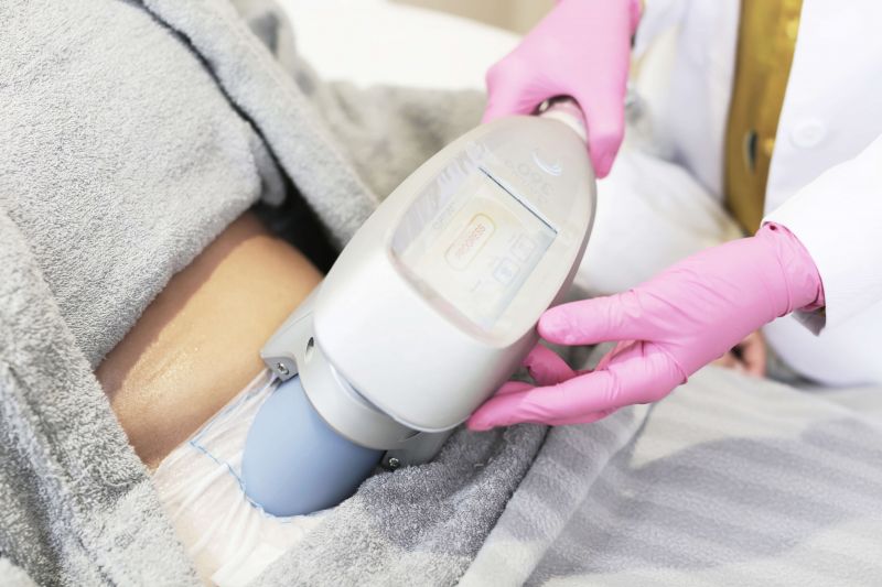 تجربتي مع تجميد الدهون ونحت القوام بتقنية CoolShaping2
