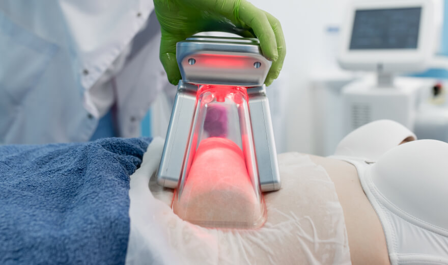 تجربتي مع تجميد الدهون ونحت القوام بتقنية CoolShaping2