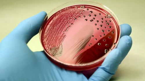 ما هو تعفن الدم وما الفرق بينه وبين إنتان الدم وكيف يمكن علاجه؟