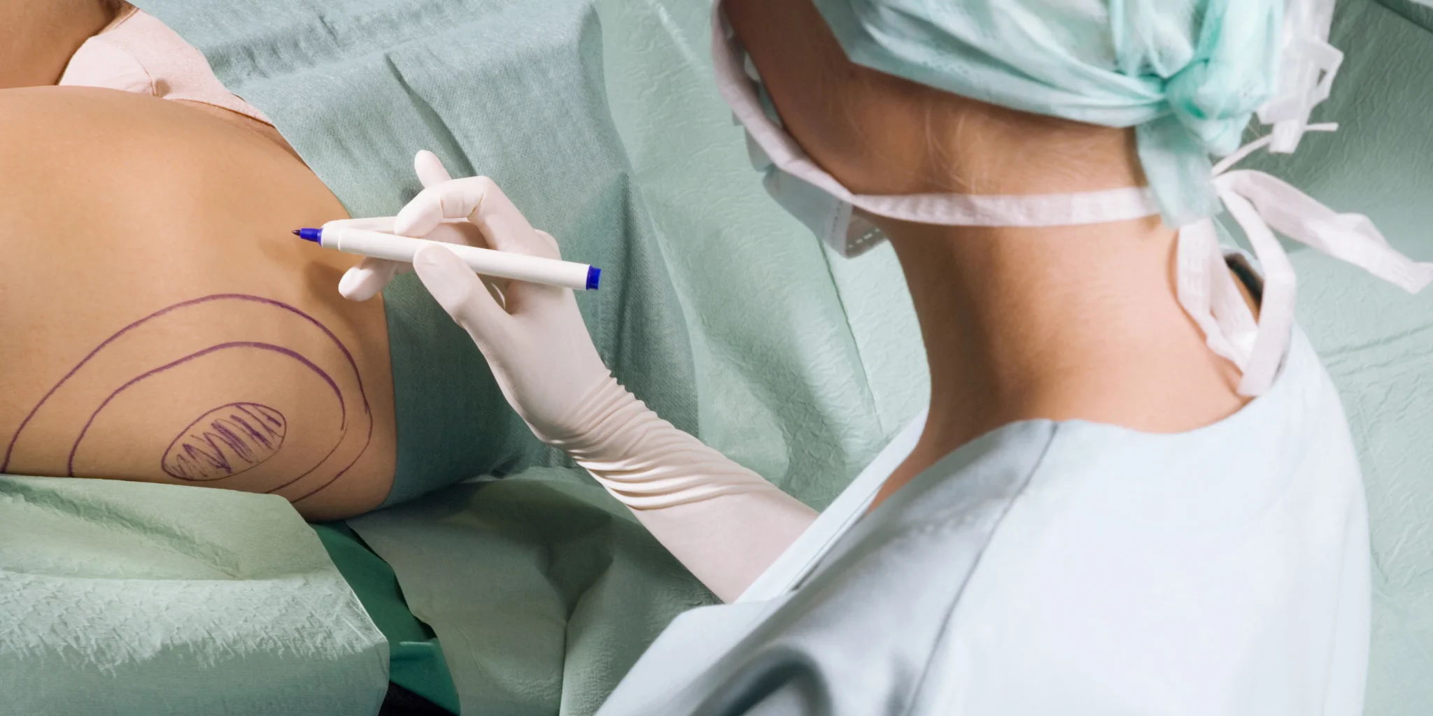 ما هي أفضل مستشفى لعملية شفط الدهون في مصر؟ وكيف تختار الجراح الأنسب لك؟