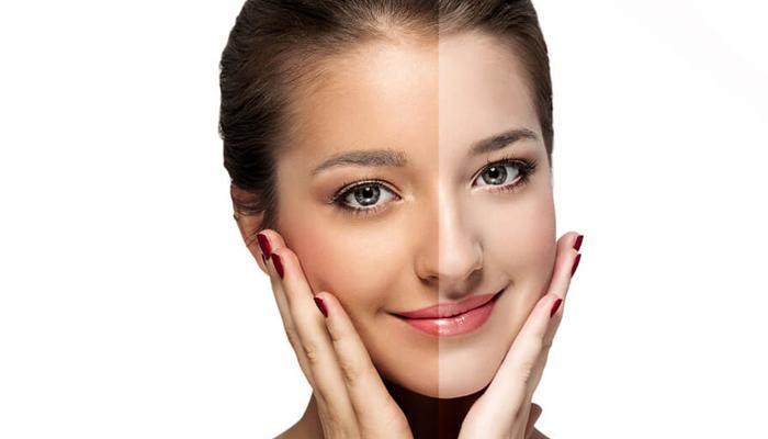 ما هي طرق تفتيح البشرة وهل يساعد الميزوثيرابي على تفتيحها؟