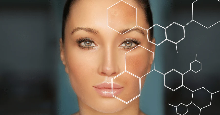 تخلصي من البقع الداكنة في الوجه في أسرع وقت - أندلسية لصحة المرأة