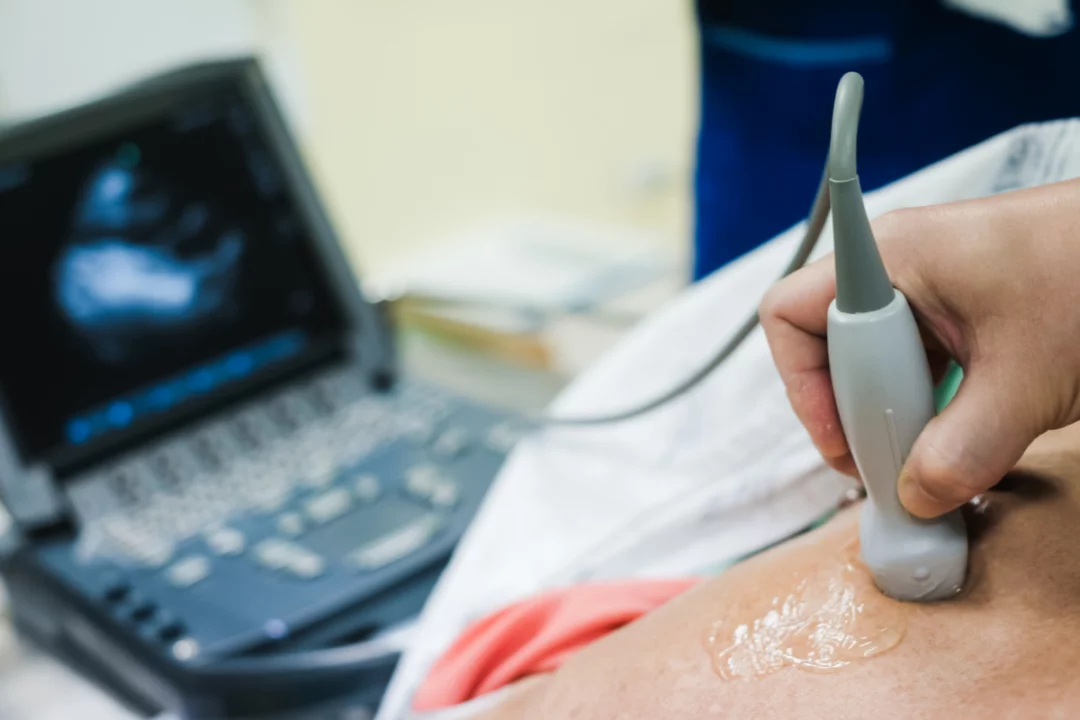 ما هي استخدامات مخطط صدى القلب ومتى يطلبه الطبيب؟