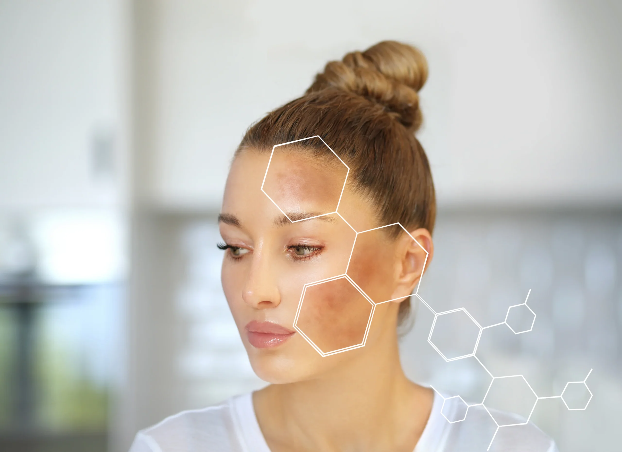 تخلصي من البقع الداكنة في الوجه في أسرع وقت - أندلسية لصحة المرأة