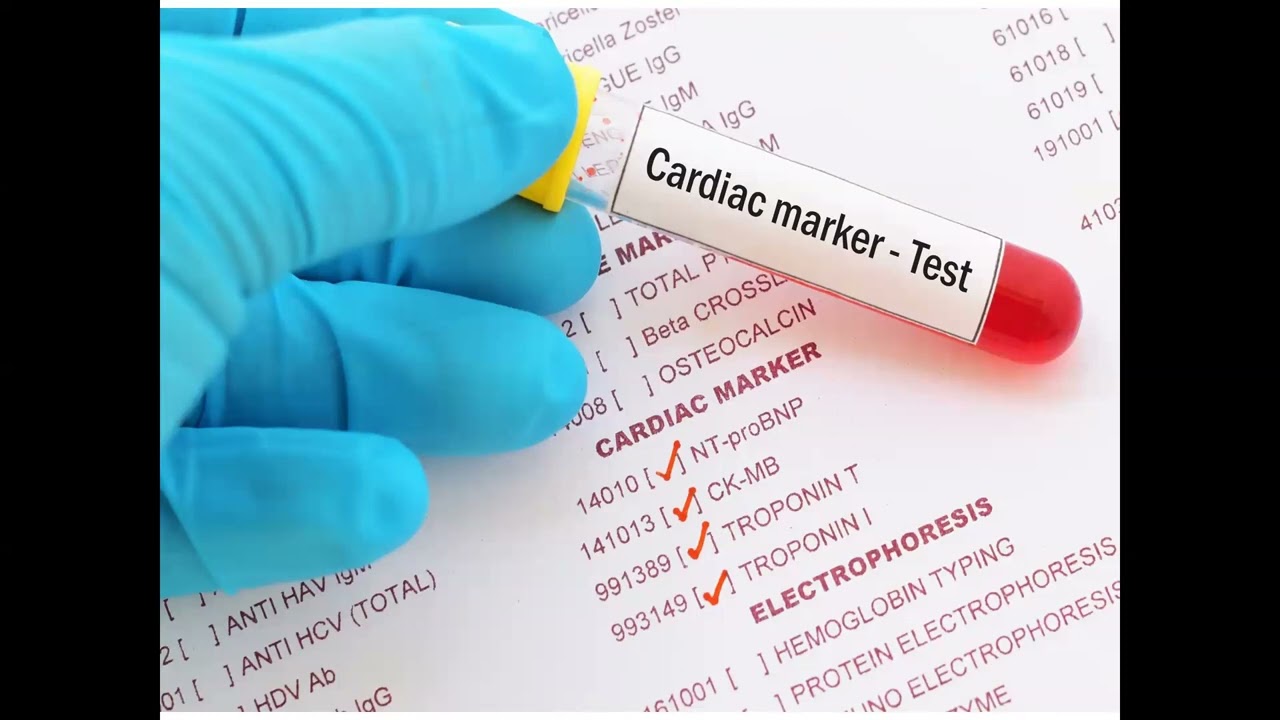 ما هي إنزيمات القلب وكيف تساعد في تشخيص أمراض القلب؟